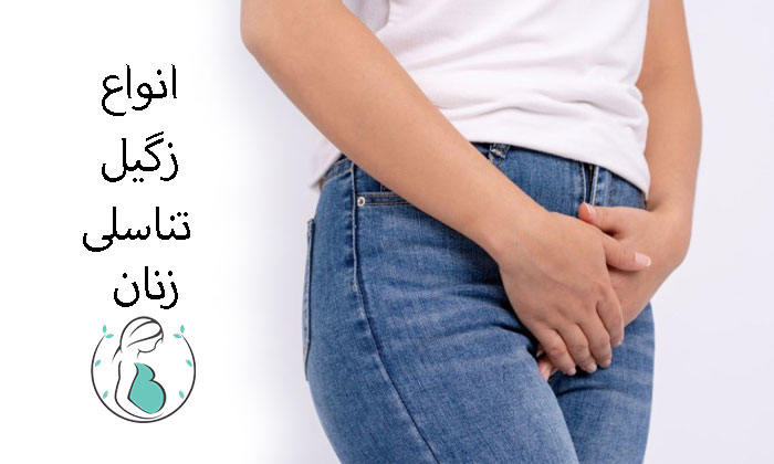 زگیل تناسلی