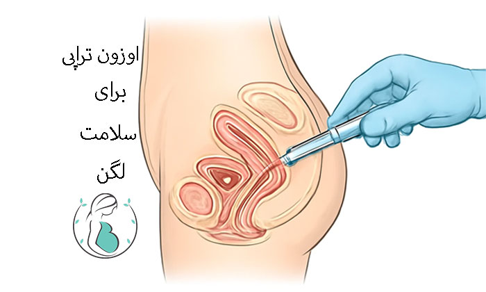 پلاسما و اوزون‌تراپی