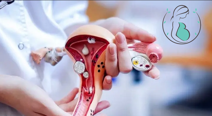 عمل هیستروکتومی