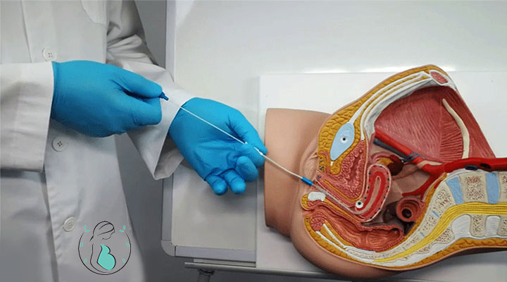 کورتاژ تشخیصی