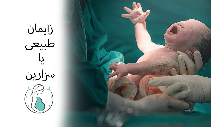 زایمان طبیعی یا سزارین؟