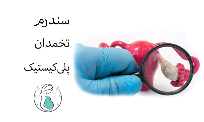 سندرم