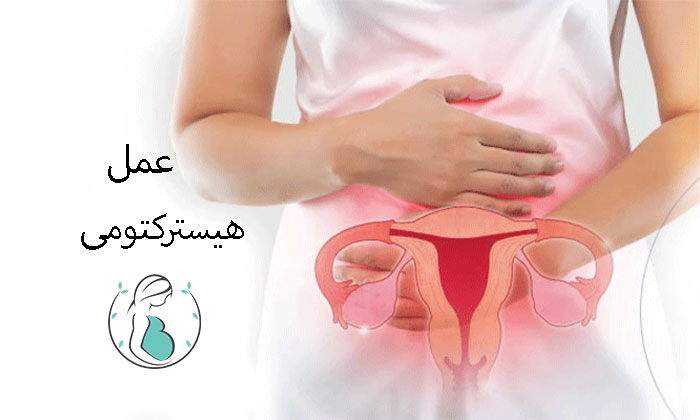 هیستروکتومی